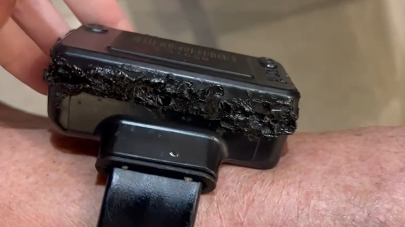 Bolsonaro admite uso de ferro de solda após relatório indicar avarias em tornozeleira