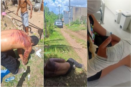 Homem é preso após tentar matar ex-companheira e sofrer “salve” de facção em Cuiabá