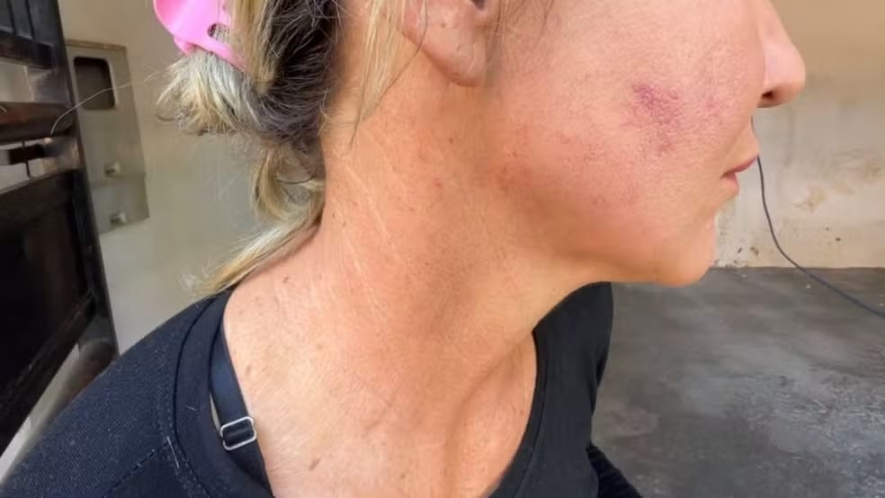 Homem espanca namorada e a arrasta pelos cabelos em posto de combustível
