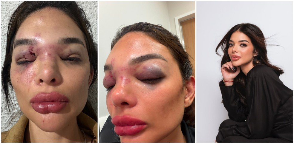 Empresário de São Paulo preso por agressão à mulher tem antecedentes em processo da CVM