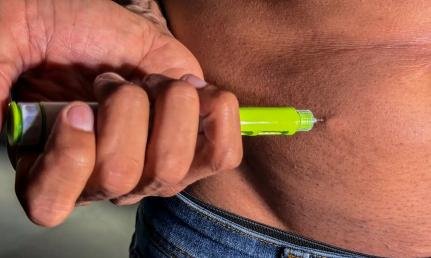 Medicamentos emagrecedores no SUS: população apoia mas duvida da implementação em Mato Grosso